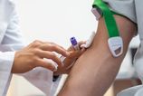 Prelom v medicine Analiza k krvi moze predpovedat riziko umrtia