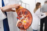 Rastuci pocet pacientov s ochoreniami obliciek na Slovensku Niekolko tisic je odkazanich na dialyzu