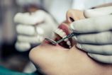 pokazene zuby nie su len estetickym problemom odbornici varuju zapal v ustach nici srdce aj penazenku